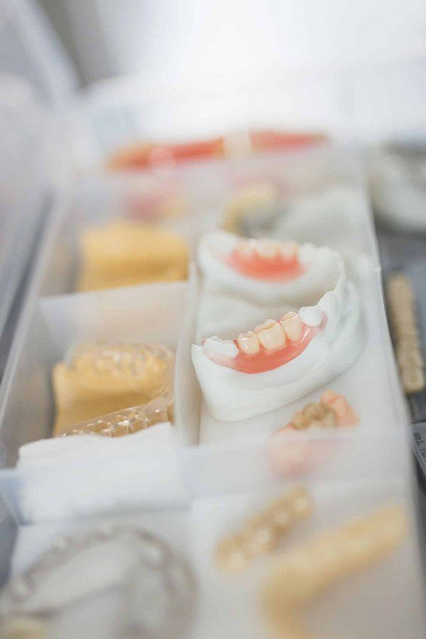 Quelles sont les dernières innovations en prothèses dentaires ?